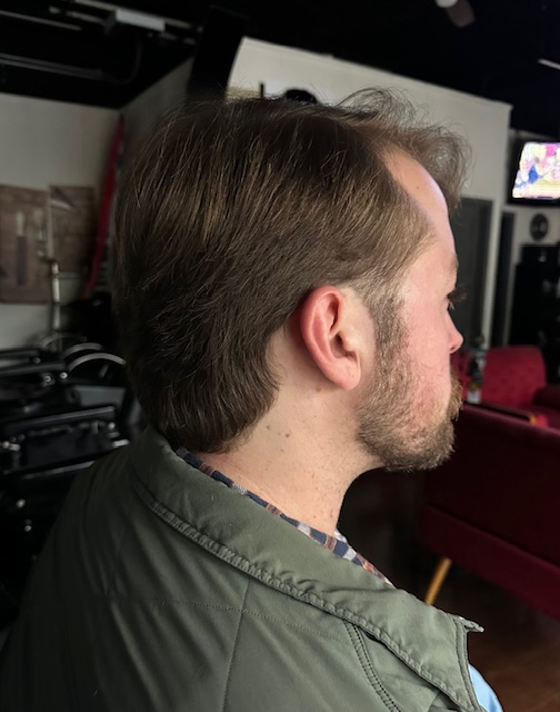 Classic cut profile view